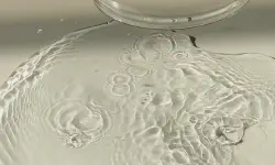 Featured image of post What Accidents Bring Us